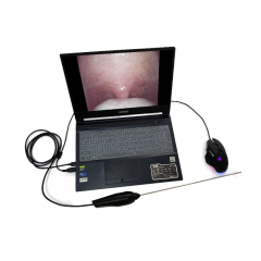 MY-P008M endoscope électronique Portable médical professionnel