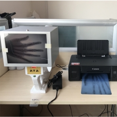 MY-D001C fluoroscopie x machine