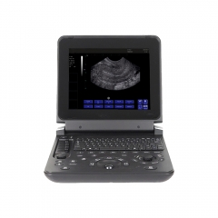 Professionnel médical MY-A007C ordinateur portable BW Scanner à ultrasons