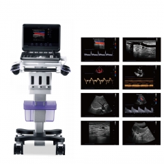 My - a032a - C système de diagnostic par ultrasons Doppler couleur portable